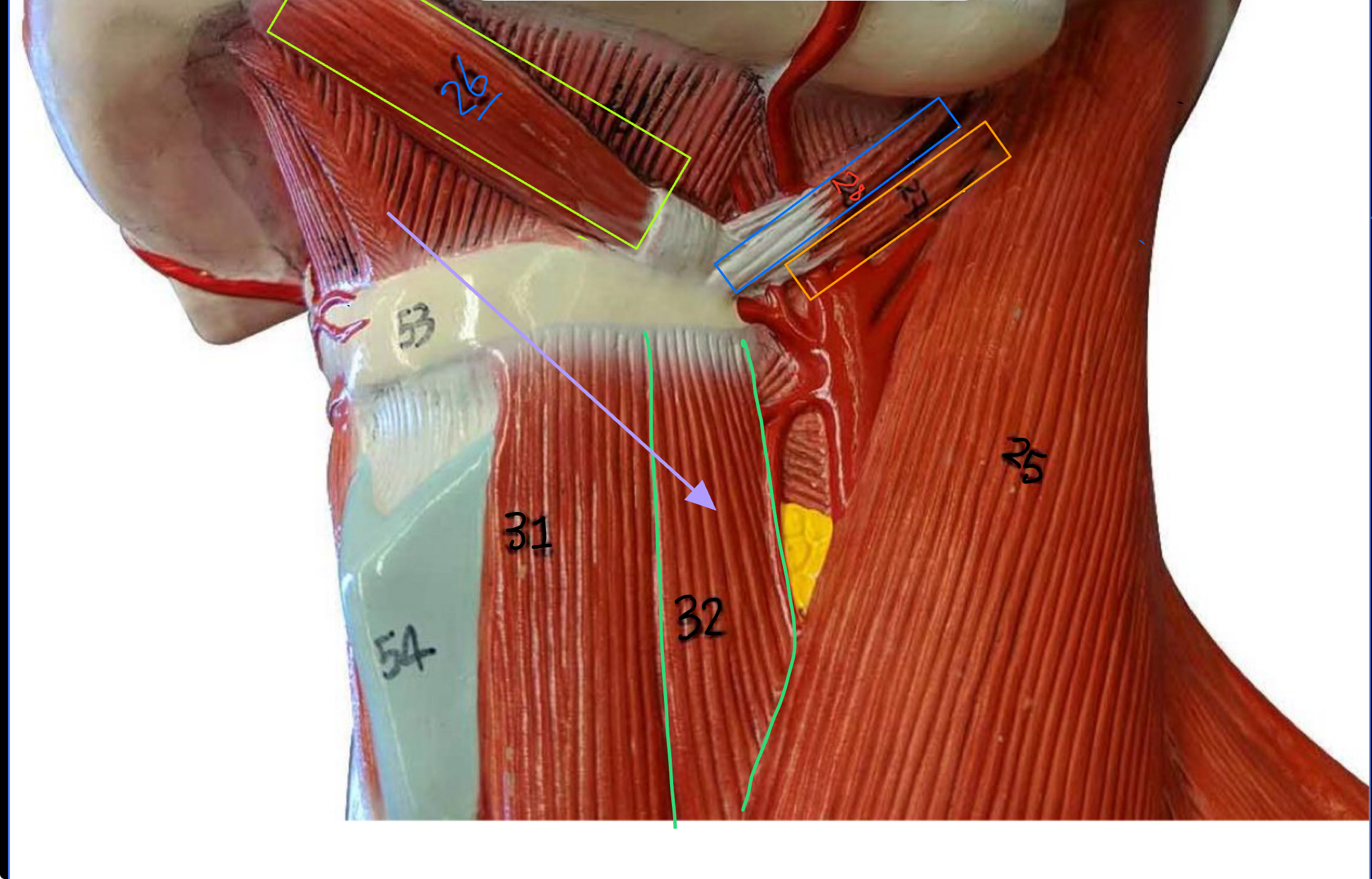 <p>What type of muscle is this ( altay model )</p>