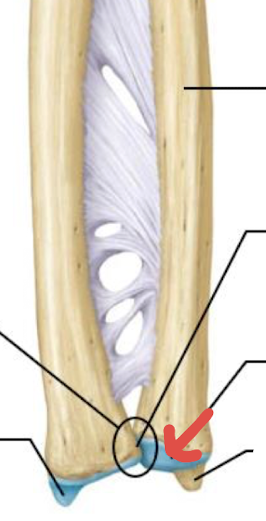 <p>what is this part of the ulna?</p>
