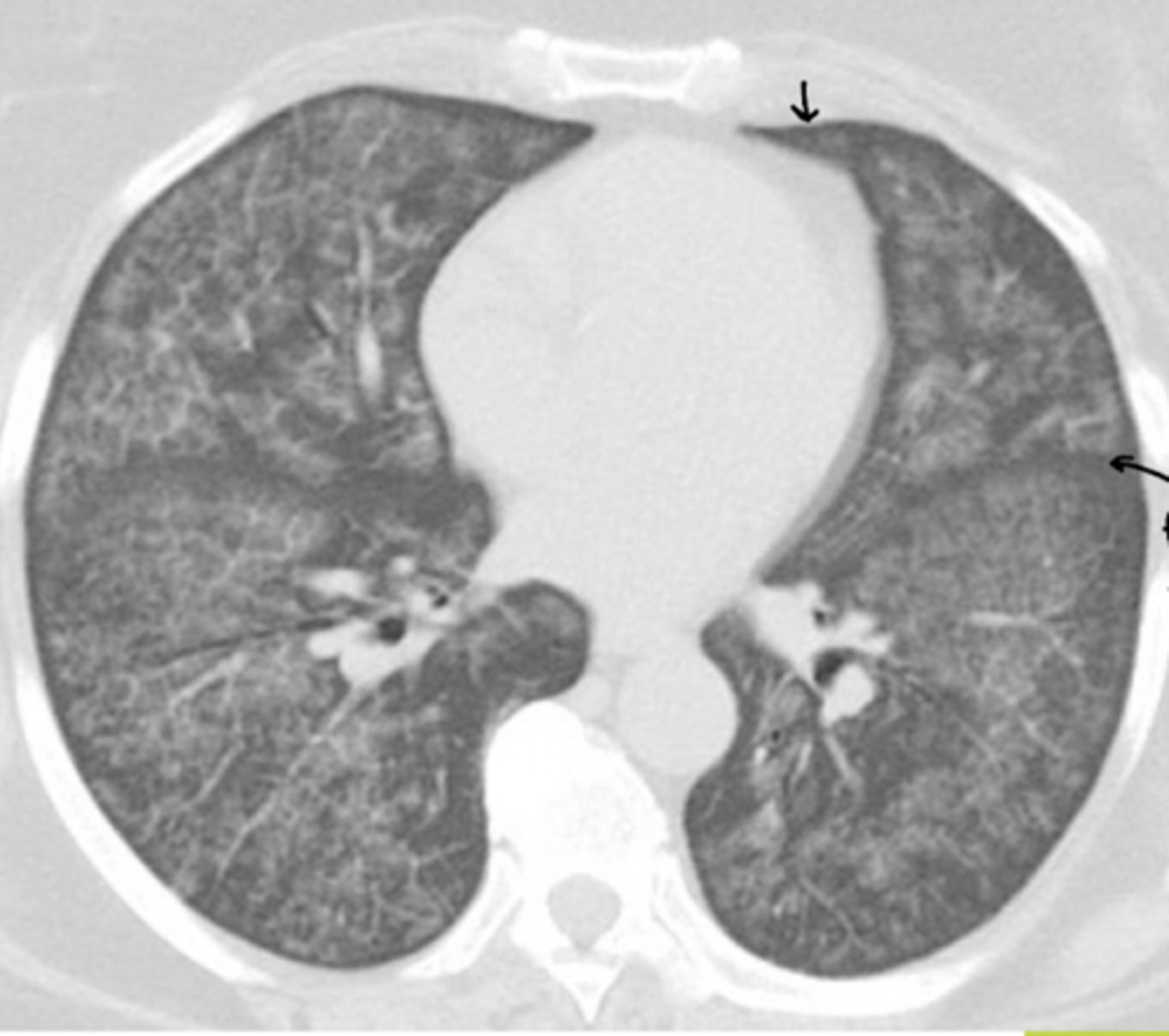 <p>Name the condition</p>