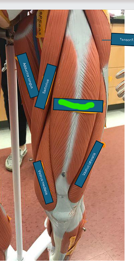 <p>flexes the thigh and extends the leg </p>