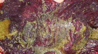 <p><span style="background-color: transparent;">Acute Colitis / Typhlocolitis</span></p>