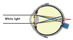<p>the blurring caused by all the wavelengths that does not focus on the retina</p><p class="p2">Chromatic blur from chromatic aberration is inherent to every single eye.<span>&nbsp;</span></p><p class="p2">There is no way around it.<span>&nbsp;</span></p>