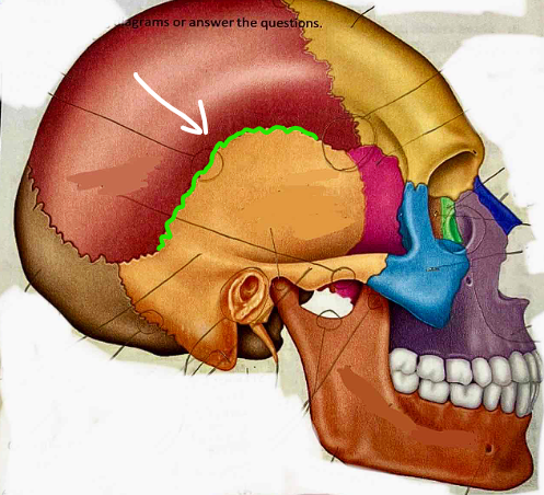<p>What suture is this?</p>