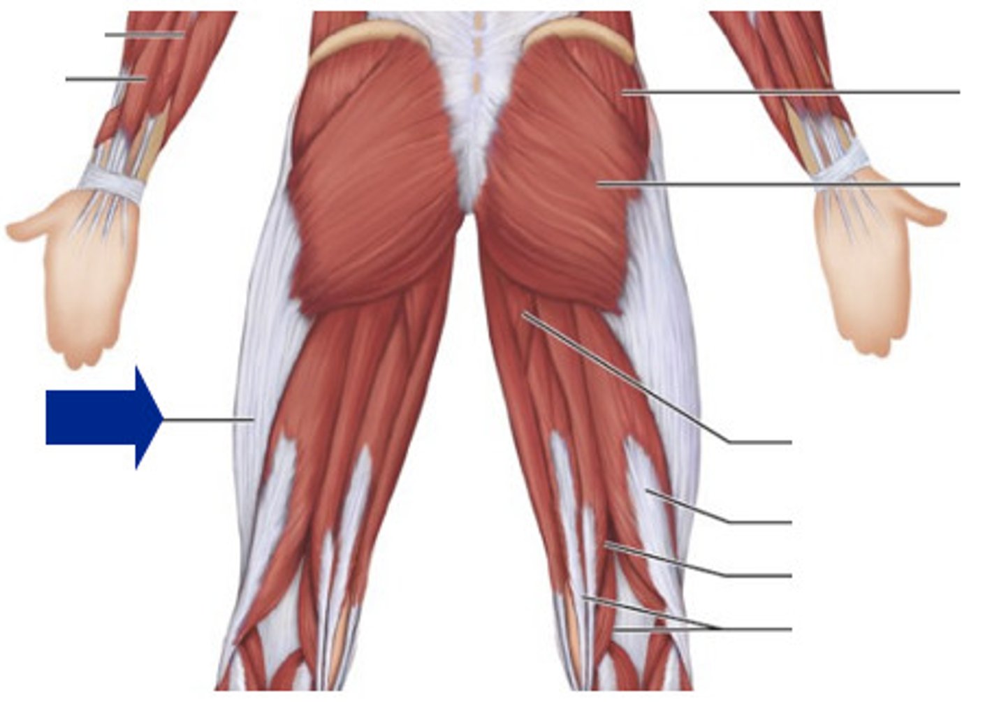 <p>a thickening of deep fascia seen on the inferiorolateral poriton of the thigh. strengthens the extended knee</p>