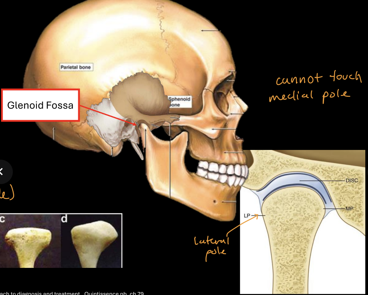 <p>top of mandibular neck, articulates with glenoid (mandib) fossa, convex, elliptical, medial/lateral poles</p>