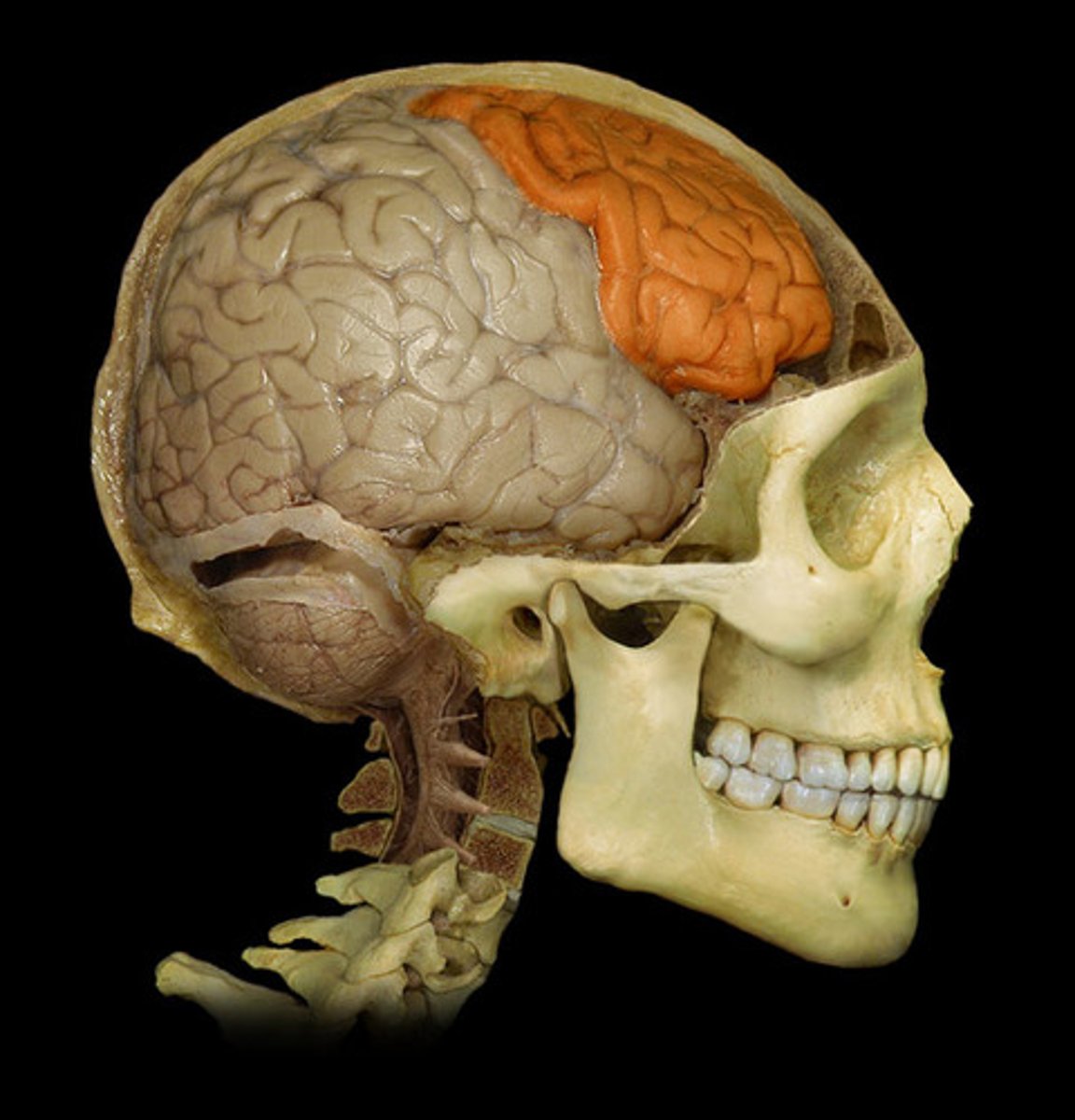 <p>low activity in patients with schizophrenia</p>