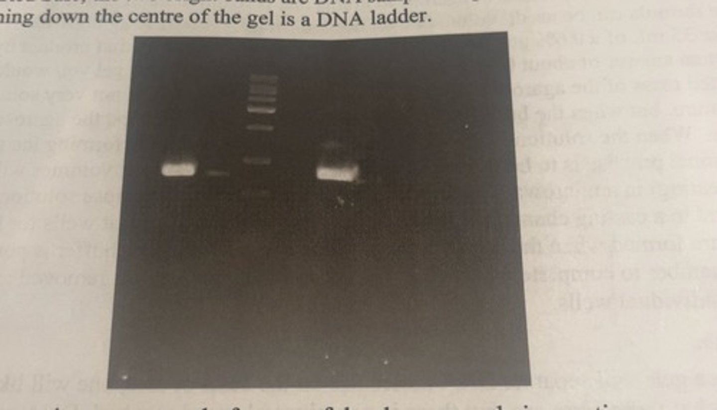 <p>-the 2 bright bands are DNA samples amplified by PCR</p><p>-the series of bands running down the centre of the gel is a DNA ladder.</p>