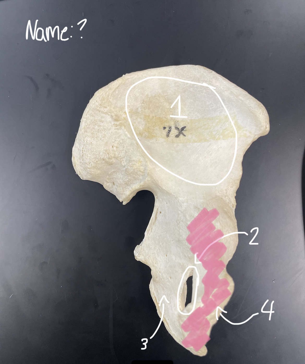 <p>obturator foramen</p>
