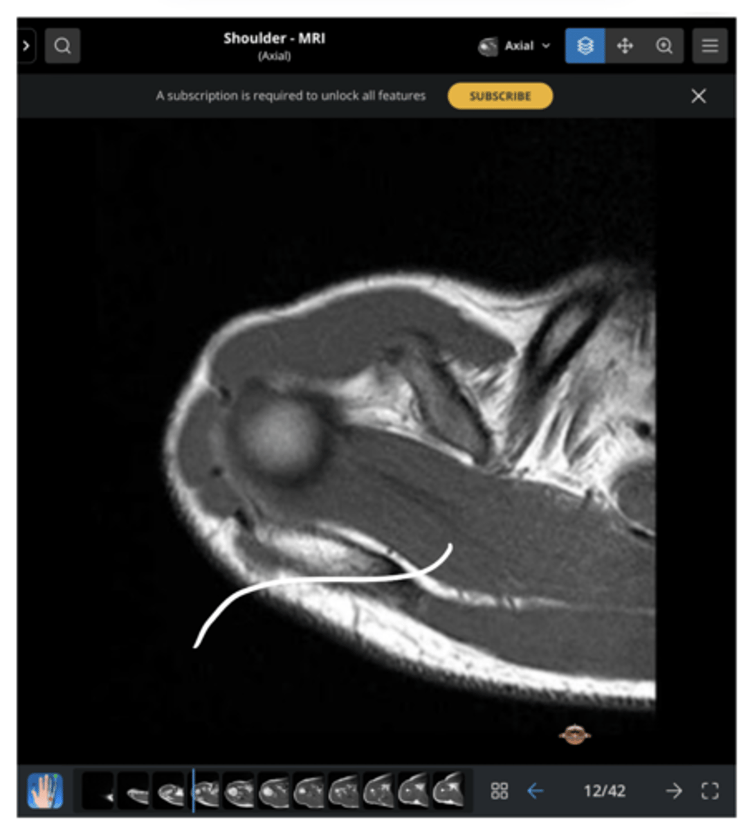 <p>Which structure is being pointed to in this image?</p>