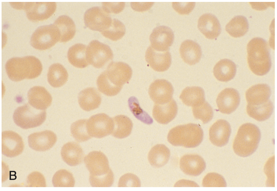 <p>A stage in the sexual development of the malaria parasite.</p>