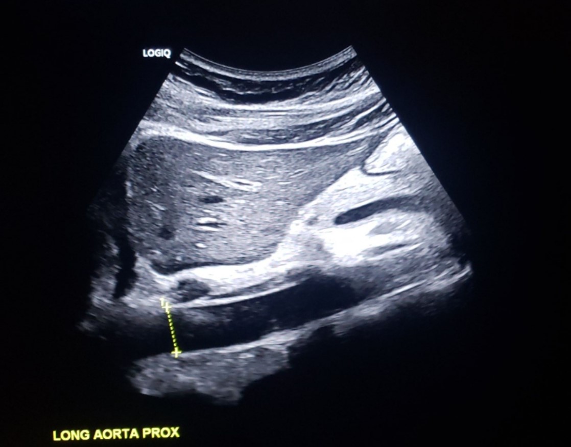 <p>(no measurement needed for protocol)</p>