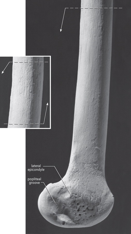 <p>groove on the lateral epicondyle</p>