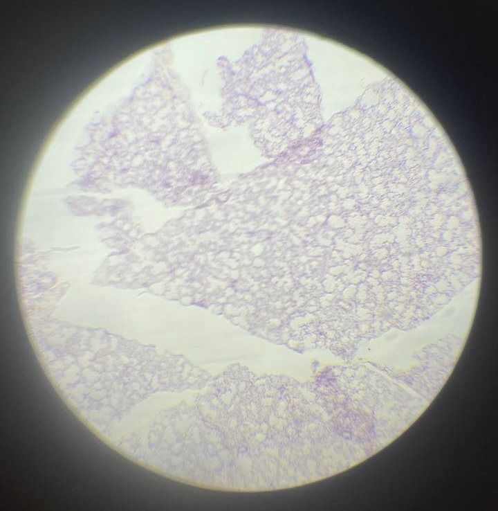 <p>Підщелепова слинна залоза </p>