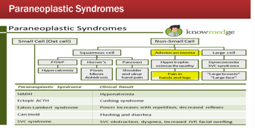 <p>symptom complexes arising in patients with cancer that cannot be explained by local or distant spread of their tumors</p>