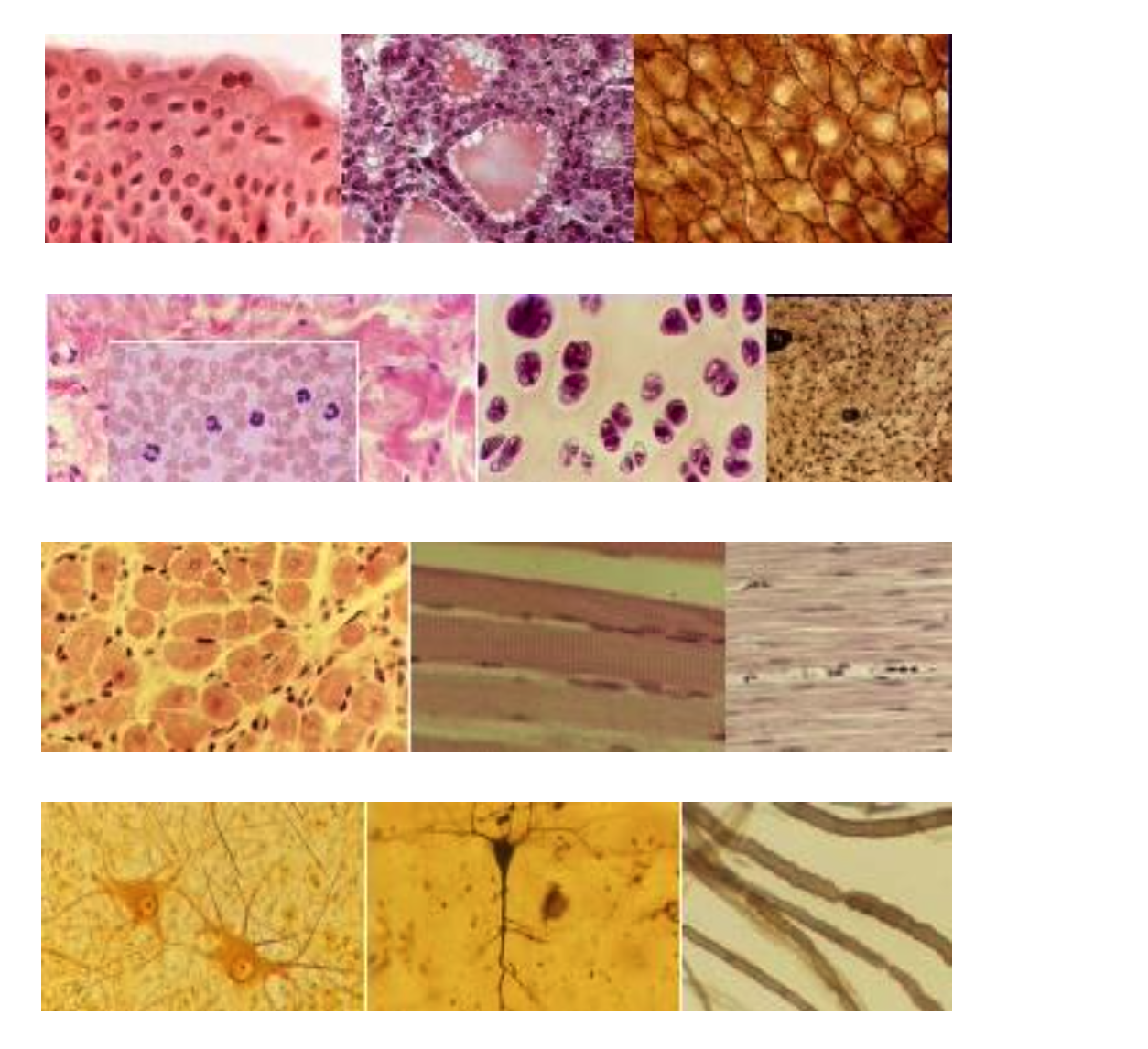 <p><span><strong>Name the Four Basic Tissue Types</strong></span></p>