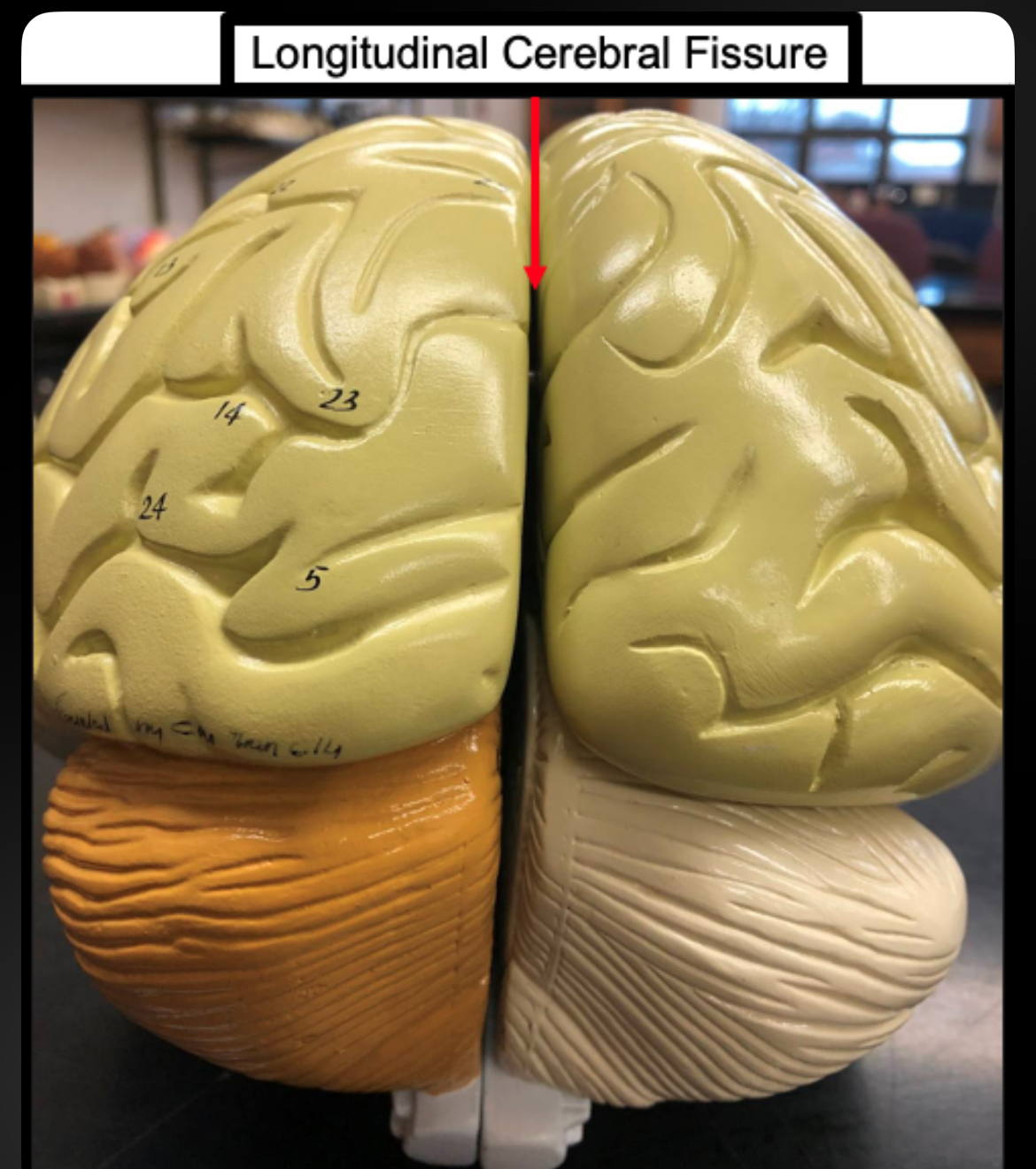 <p>Longitudinal Fissure</p>