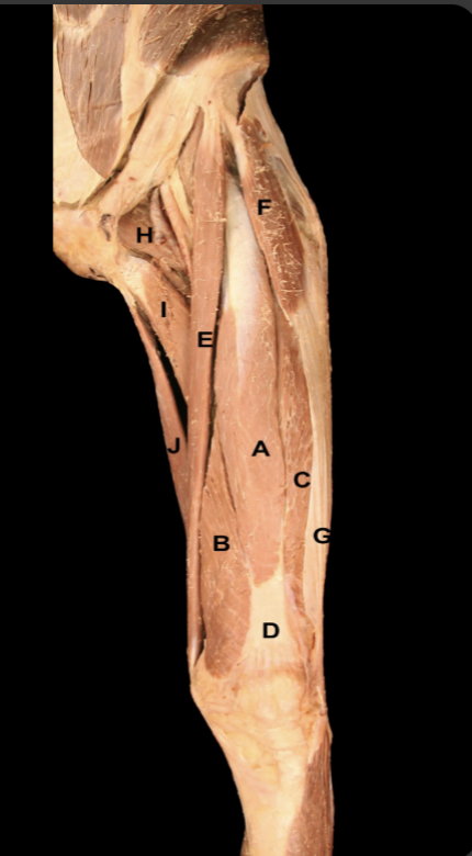 <p>Which muscle lies just deep to “A”? What is the distal attachment of this muscle? </p>