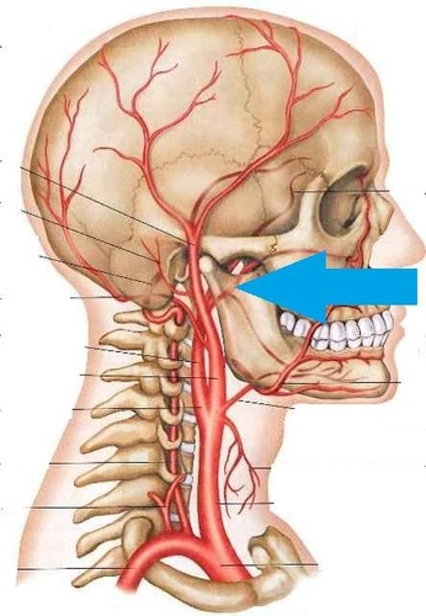 <p>This artery may be the most important artery to dentist and hygienist. Its own branches consist of three parts that</p><p>separately supply blood to the mandibular teeth (mandibular part-inferior alveolar artery, mental artery, and incisive artery), the four muscles of mastication (pterygoid part), and the maxillary teeth and</p><p>palate (pterygopalatine part-PSA artery, infraorbital artery, MSA artery, ASA artery, and descending palatine artery)</p>
