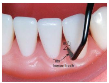 <p>70-80 degrees (may be 60-80, depending on who you ask) tilted TOWARDS tooth surface </p>