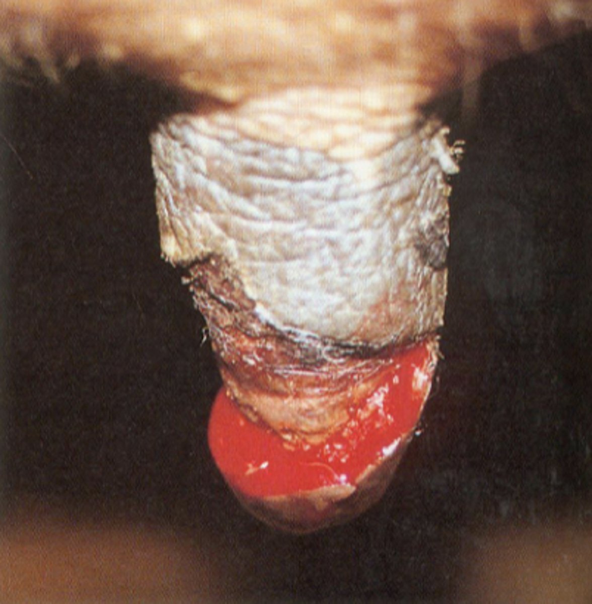 <p>Hvad er den mest sandsynlige årsag til denne læsion?</p><p>- For stort vacuum på malkeanlæg</p><p>- Bovin herpes mammilitis</p><p>- Pattetråd</p><p>- Solskoldning</p>