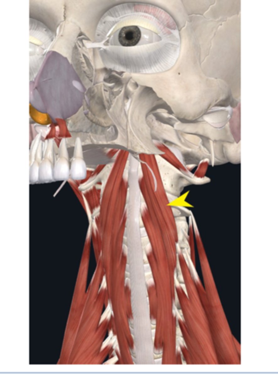 <p>What is this muscle?</p>