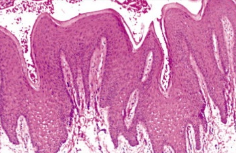term image