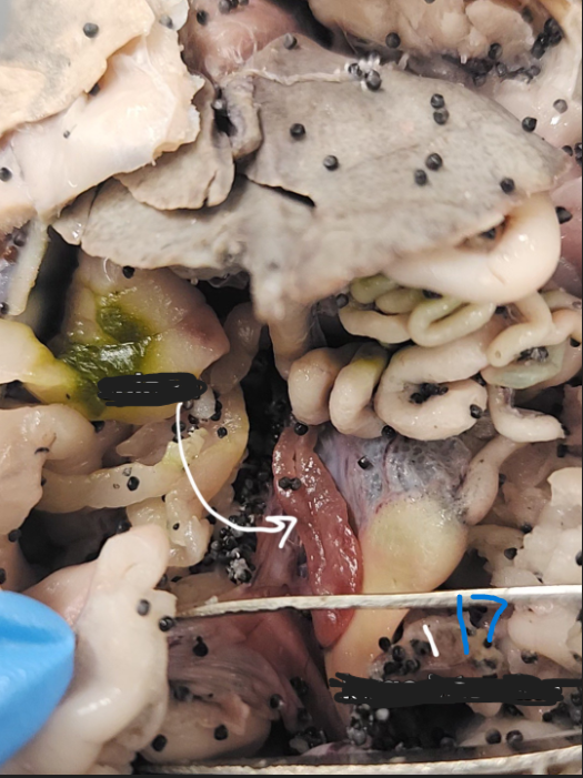 <p>What is option 17</p>