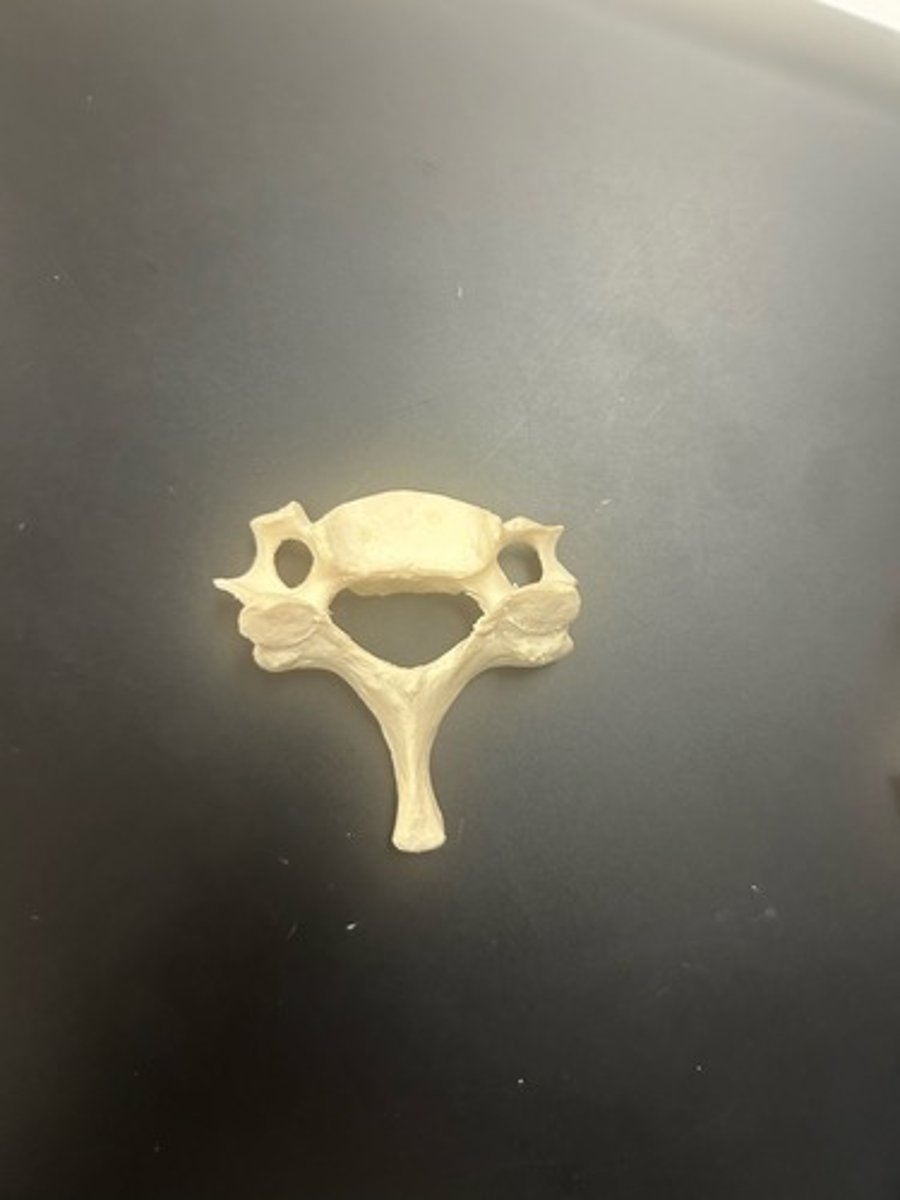 <p>name the bone</p>