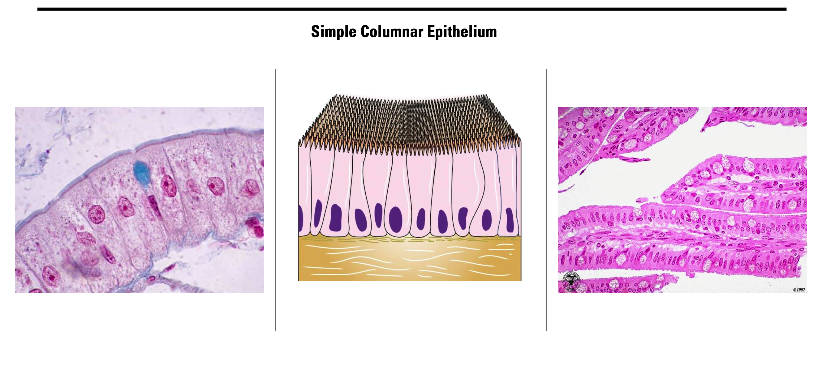 <p><span><strong>Simple Columnar Epithelium</strong></span></p>
