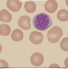 What kind of leukocyte is this?