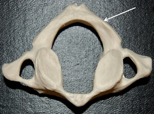 supports the head