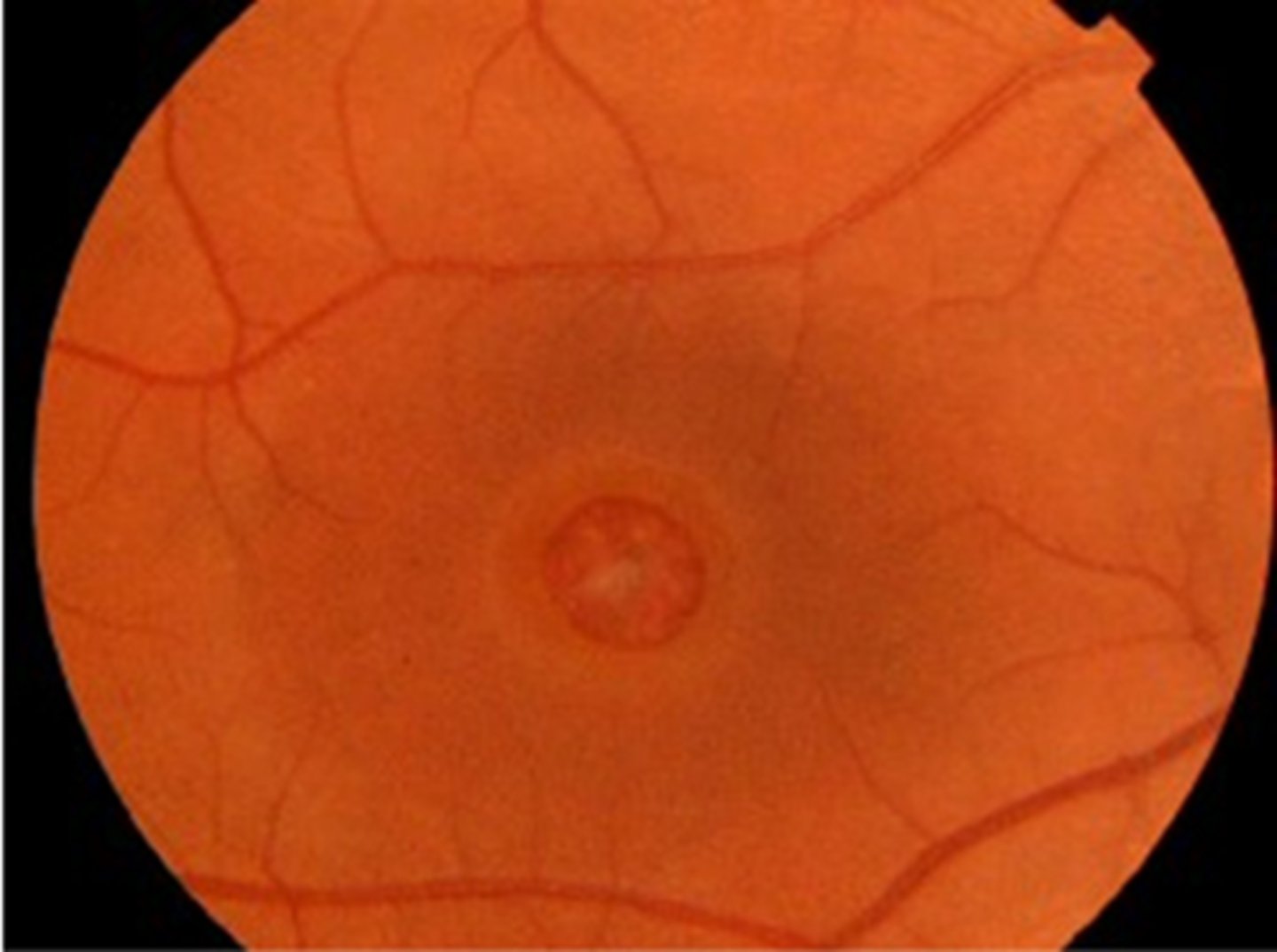 <p>place a vertical beam over fovea, pt should see a break in beam</p>