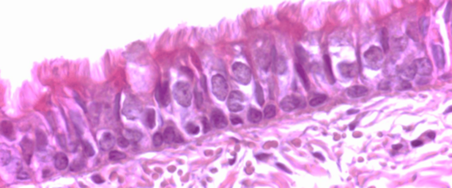 <p>classify this epithelium</p>