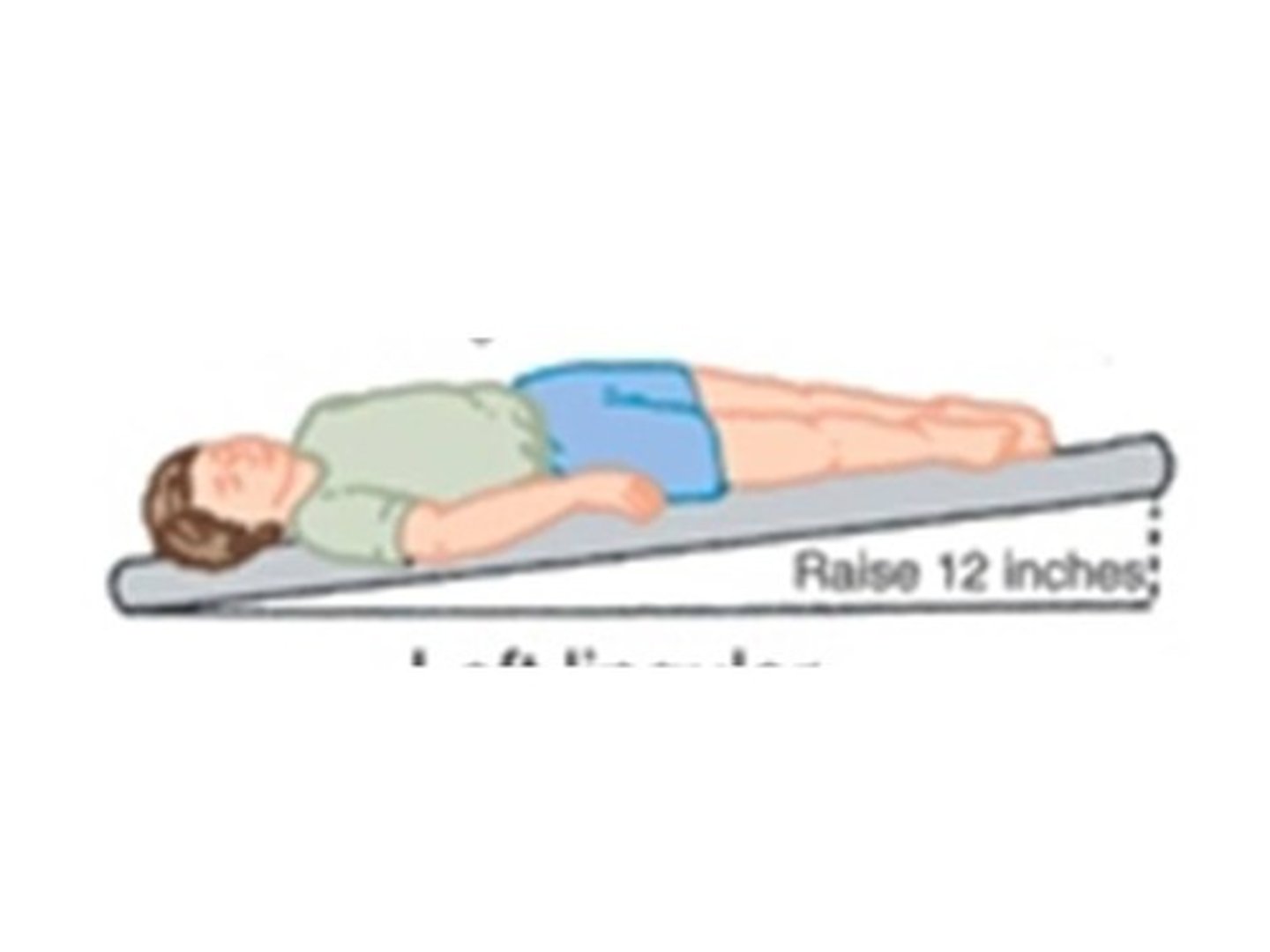 <p>-Position the patient one quarter turn from supine resting on the right side with the foot of the bed elevated 12 inches</p><p>-Area to percuss is just over the left nipple and under the armpit</p>