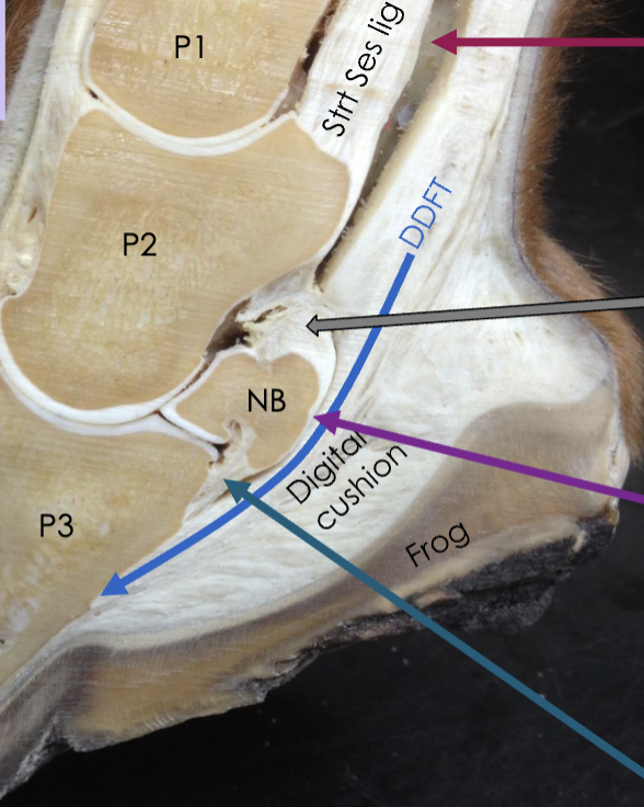 <p>what is the grey arrow</p>