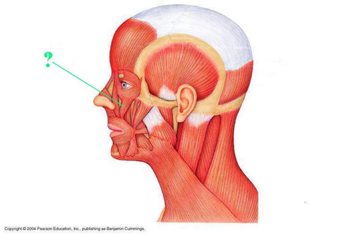 <p>Identify the indicated muscle</p>