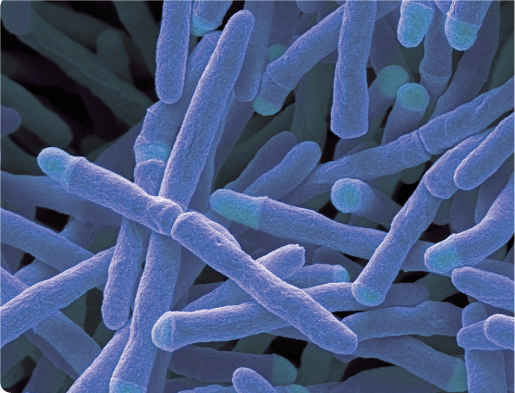 * acid-fast rod, nonmotile (technically gram positive)
* obligate aerobe
* facultative intracellular parasite
* very slow grower 
* catalase positive
* include Mycobacterium tuberculosis and M. leprae