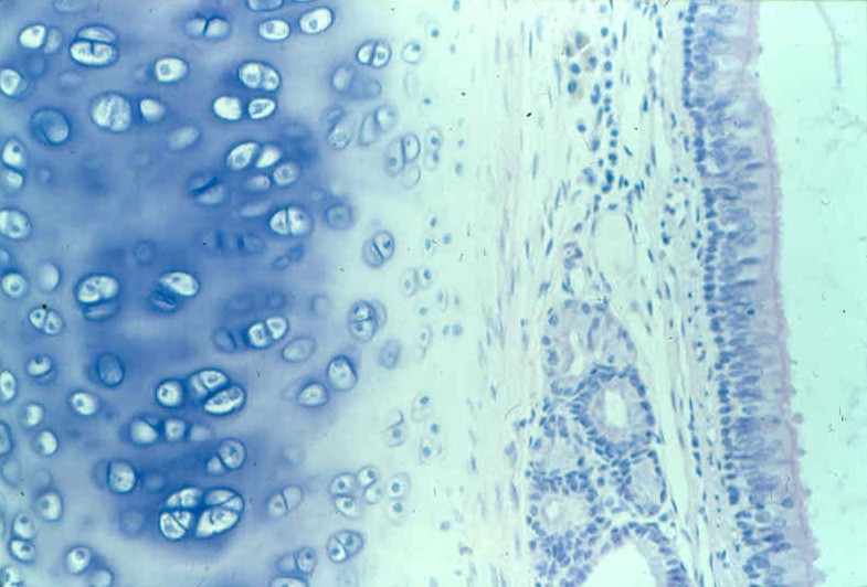 <p>What lies below the epithelia (connective)</p>