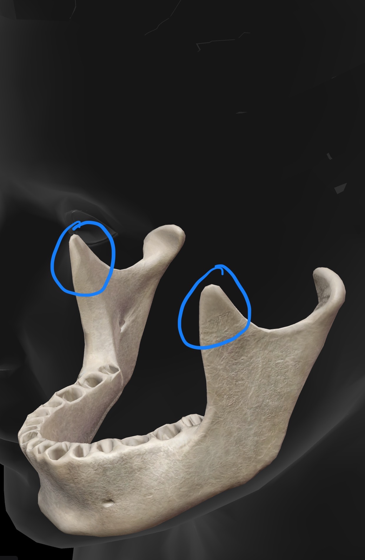 <p>What is the name for this bone and bone landmark, what does the landmark do?</p>