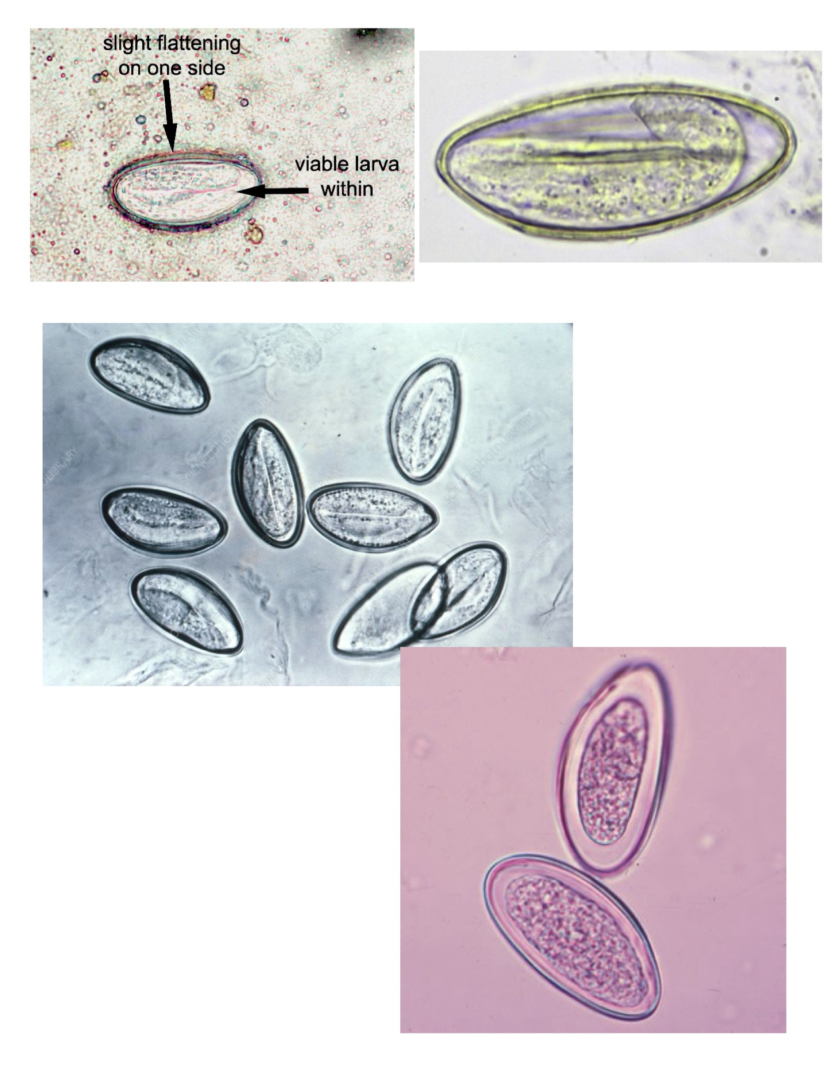<p>Enterobius vermicularis eggs</p>