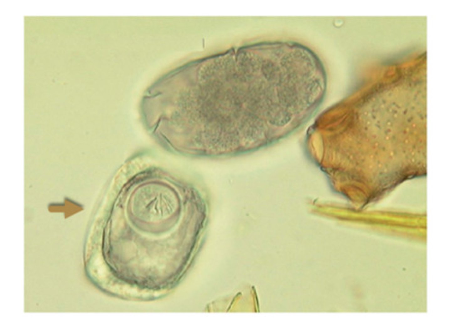 <p>The ovum of the ruminant tapeworm is called</p>
