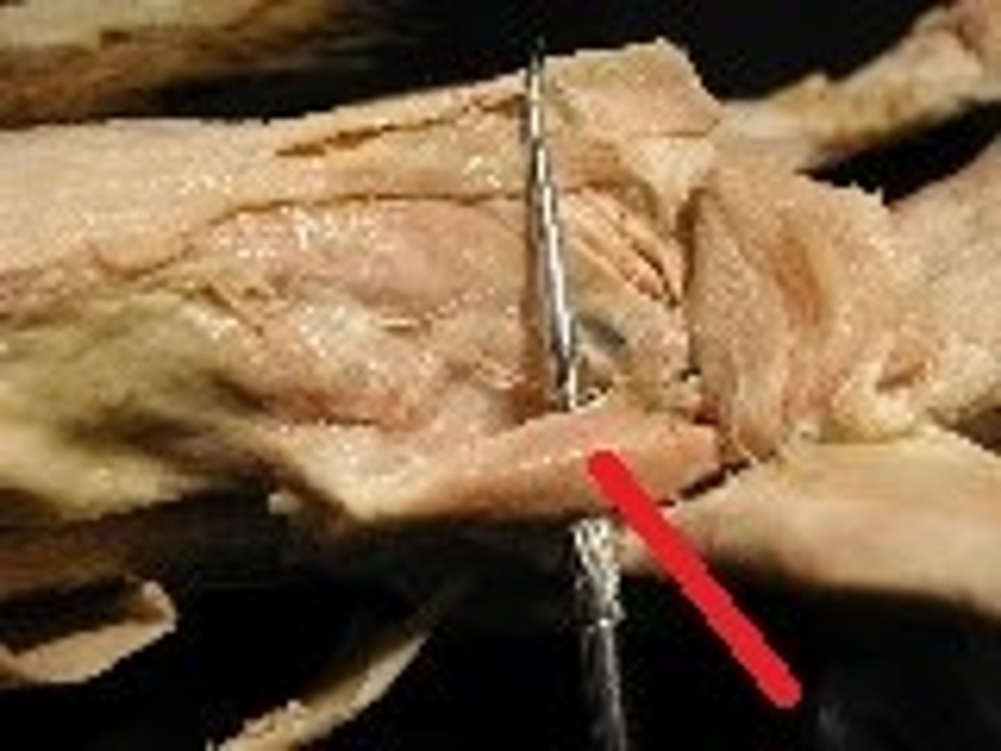 <p>What is this muscle?</p>