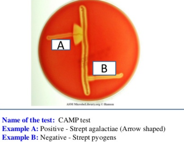 <p>Blood Agar: CAMP Factor Production — What result is pictured here?</p>