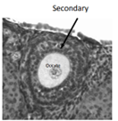 <ul><li><p>Surrounded by several layers of follicular cells</p><ul><li><p>2 or more layers of cells</p></li></ul></li><li><p>Formation of thecal (outermost) and granulosal cells (innermost)</p></li><li><p>No antrum</p></li></ul>