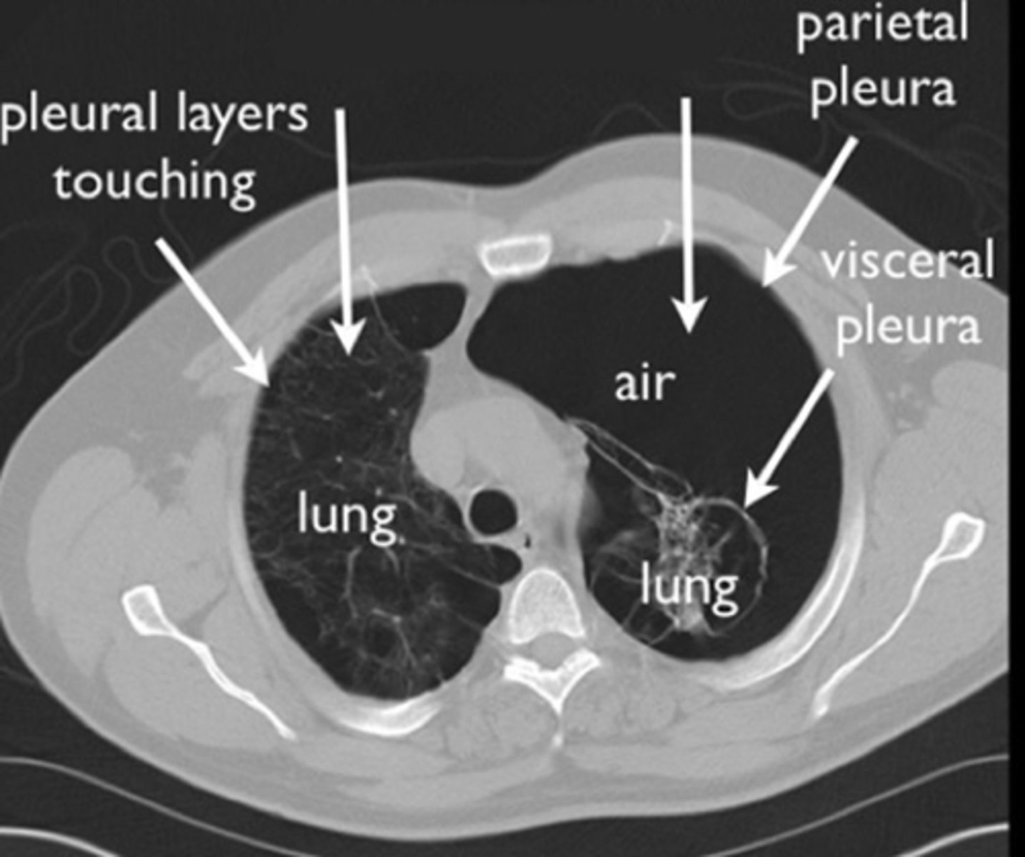 <p><em>identify the pathology:</em></p>