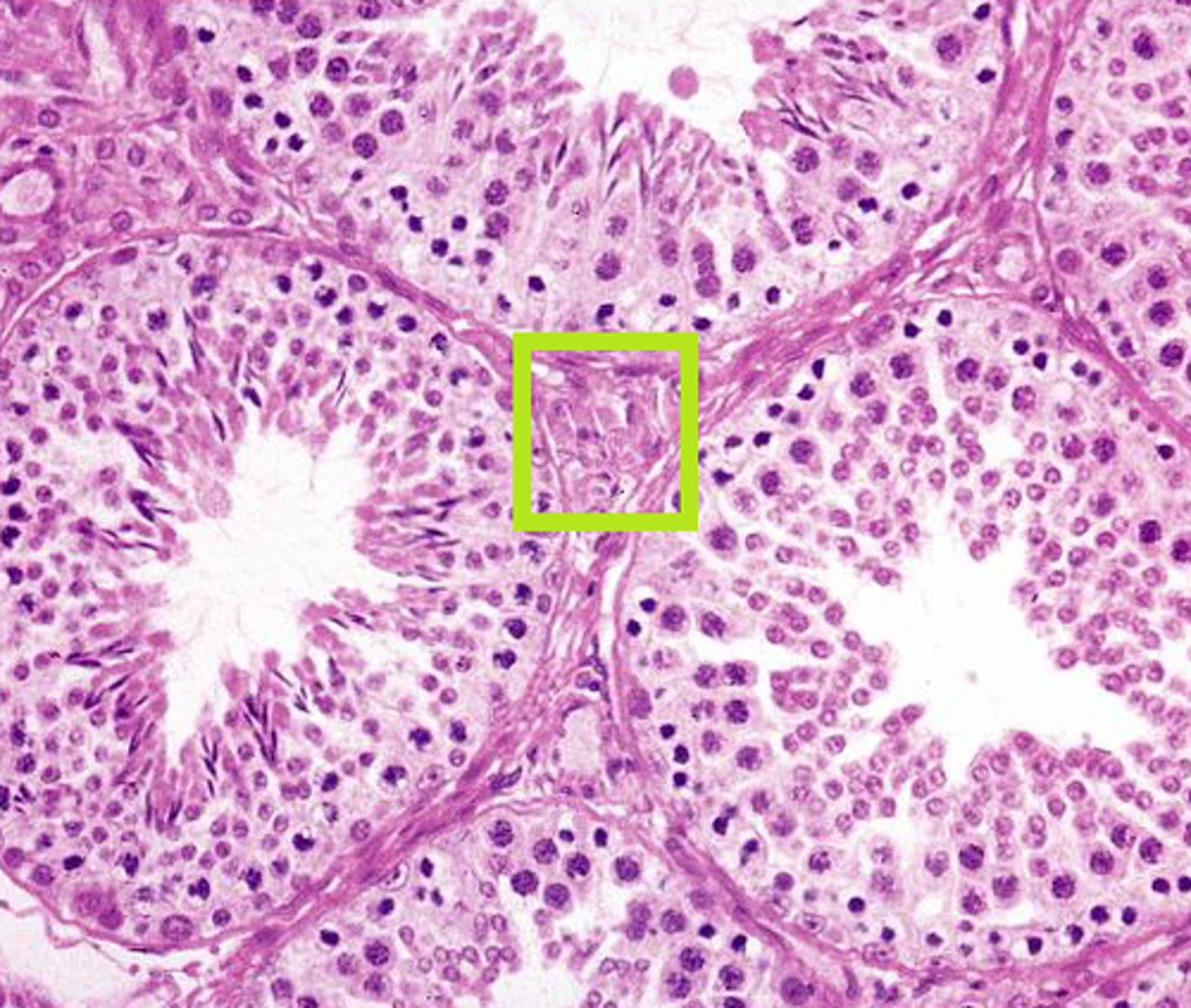 <p>In the testes, these cells lie between the seminiferous tubules and produce the hormone testosterone; stimulated by LH from the pituitary gland</p>