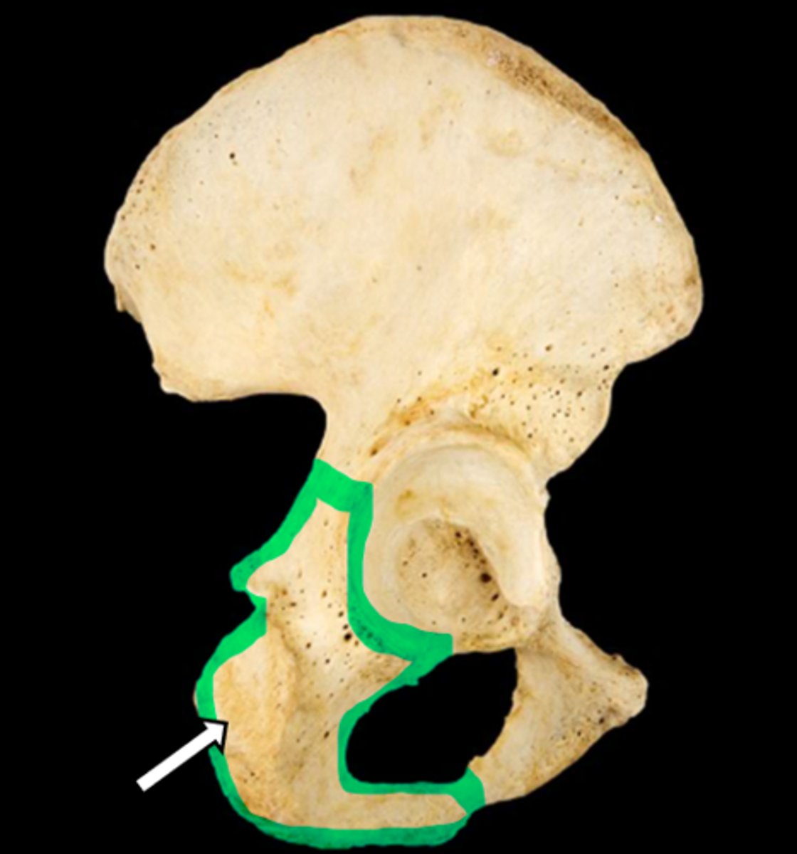 <p>name the part</p>