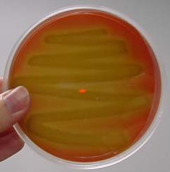 <p>What type of hemolysis is this?</p>