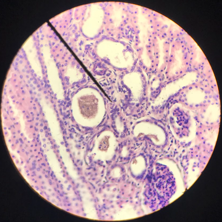 <p>squarish cells w/ centrally located nucleus; nuclei are spherical and large</p>