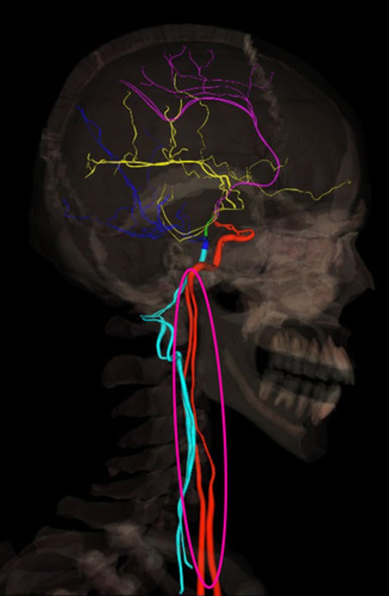<p>enters through carotid canal from common carotid; travels through the petrous part of the temporal bone and cavernous sinus to provide anterior blood supply to the brain via the anterior and middle cerebral arteries</p>